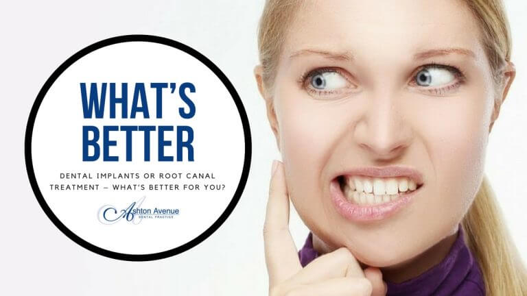 Dental Implants or Root Canal Treatment