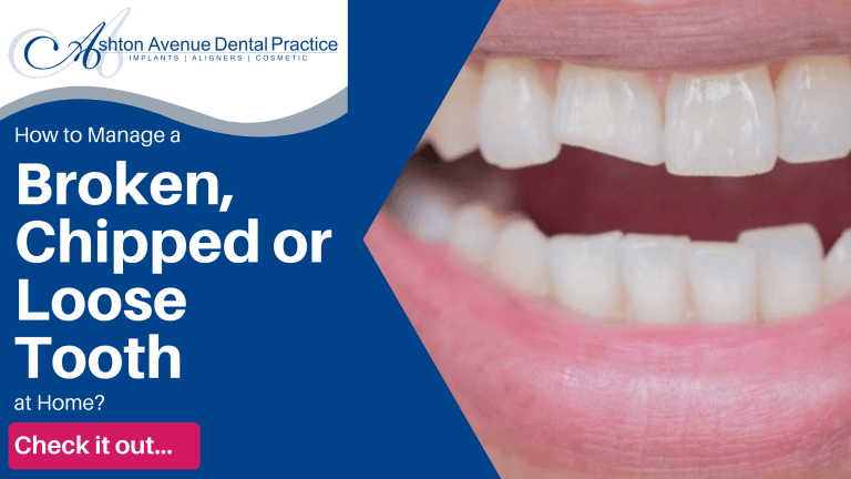 How to Manage a Broken Tooth at Home