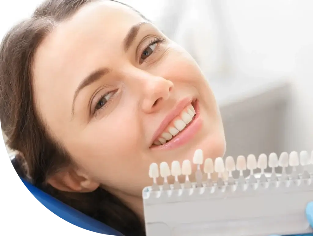 The cost of Teeth Whitening