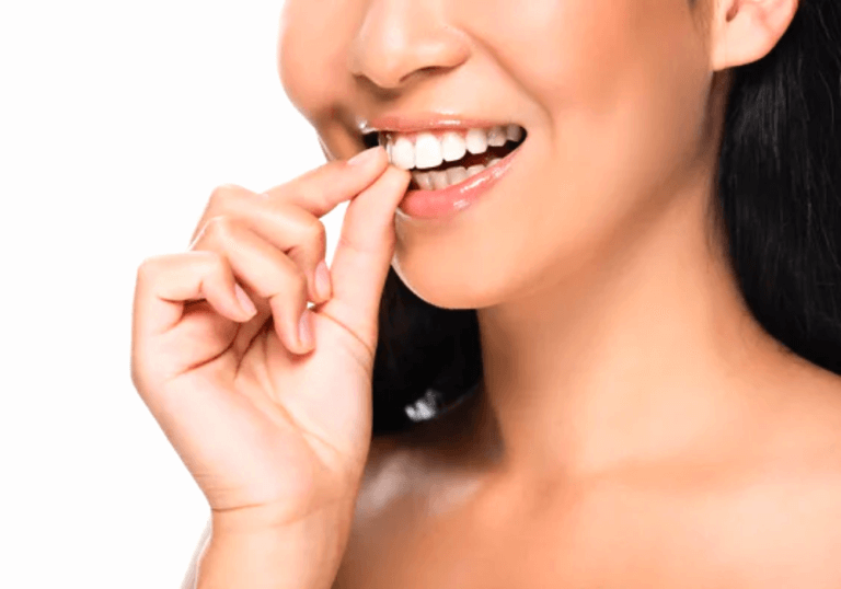 Porcelain Veneers Claremont, dentist in Claremont