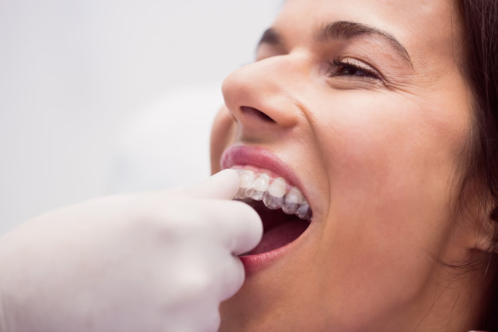 Clears aligners in Claremont