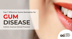 gum disease care in claremont
